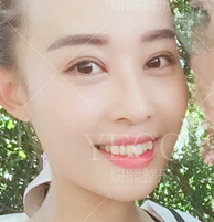 脱变10天