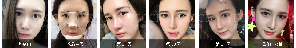 重塑完美童颜