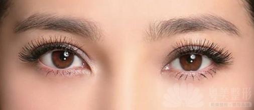 双眼皮术后眼睛痒怎么办？