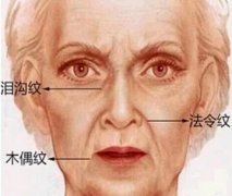 整形术后你要如何调整心态