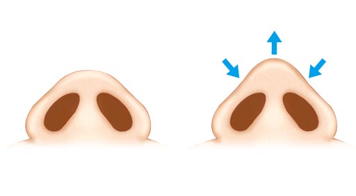 达拉斯鼻部综合整形有哪些优势