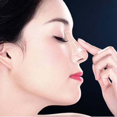 鼻部整形术分为哪些种类呢？