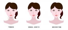 <b>做埋线提升除皱效果怎么样</b>